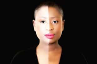 dépigmentation_togopeople