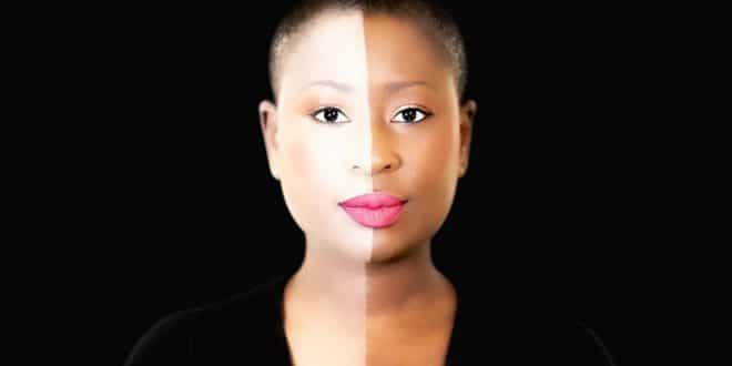 dépigmentation_togopeople